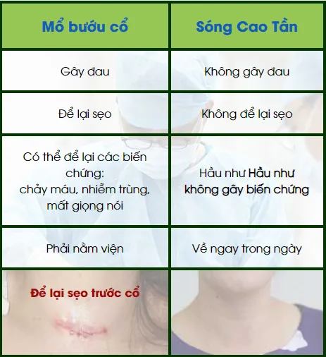 song cao tần rfa