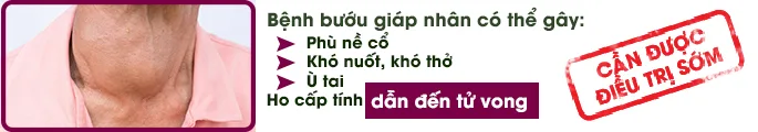 can-duoc-dieu-tri-som-buou-giap-nhan