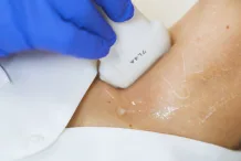 young-woman-doing-neck-ultrasound-examination-at-hospital_bjffpgu_x_thumbnail-full01