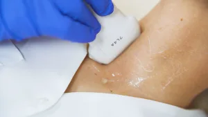 young-woman-doing-neck-ultrasound-examination-at-hospital_bjffpgu_x_thumbnail-full01